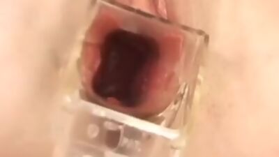 Facial teen sucks cock and takes medical objects in pussy