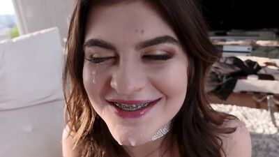 Bracefaced Prom Date Loves To Suck