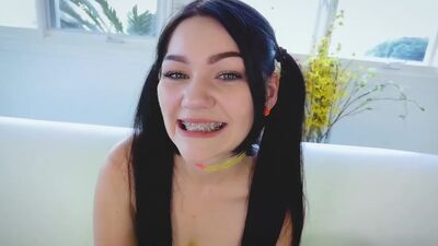 The Original Brace Face