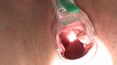 lColsoesuepu pa maamtaetueru r bbaabbee  ggeettss  ddeeeepp  ffiinnggeerrii