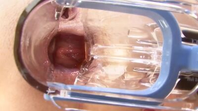 PervCity Kagney Linn Karter Anal Overdose with Mike