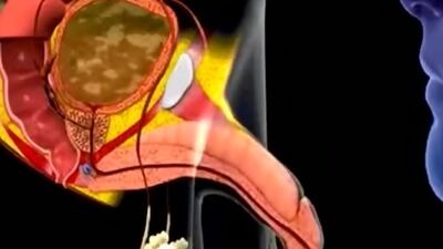 Cum in mouth animation