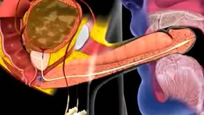 Cum in mouth animation