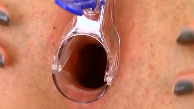 A great speculum orgasm with Alexandra